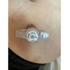 Sterile Silicone Einweg-Endotrachealröhre Knopf Gastrostomie für Erwachsene